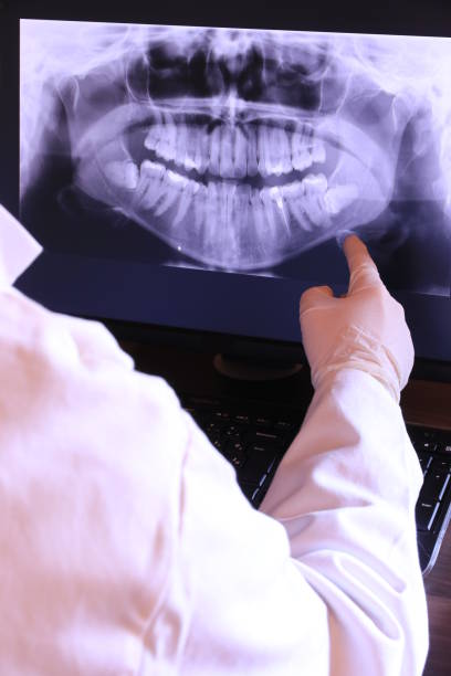 Best Mobile Emergency Dentist in Running Springs, CA