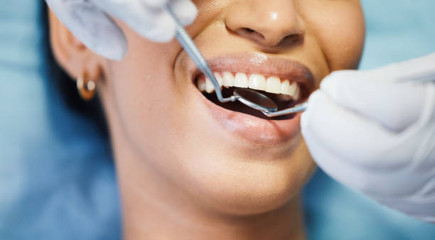 Best Emergency Dental Extractions in Running Springs, CA